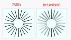 眼睛散光 – 儿童眼睛散光、远视、弱视的相关性